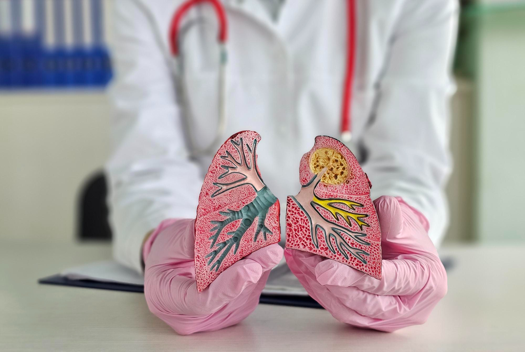 Symptoms to Solutions